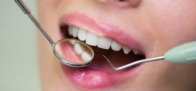 Ortodoncia vs. Invisalign: Cuál es la Opción Perfecta para Tu Sonrisa